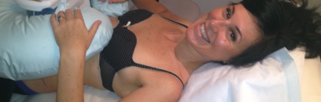 Cool Sculpting Treatment Ilke Featured Image Smiling Lady