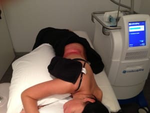 Cool Sculpting Treatment Ilke Sideview and Back