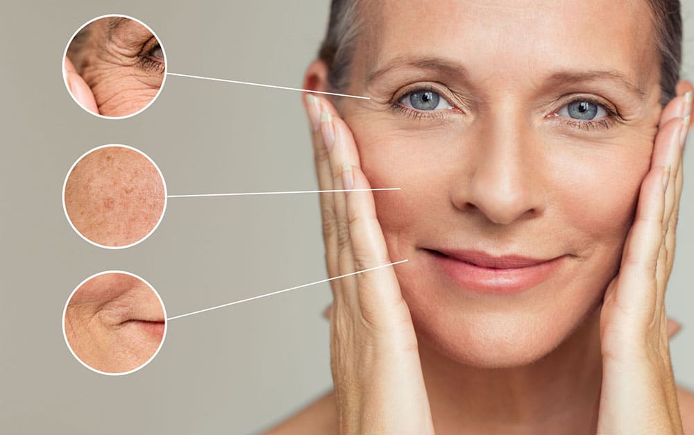 IPL Skin Therapy – Slowing Down The Visible Signs of Ageing - Skin Close Up