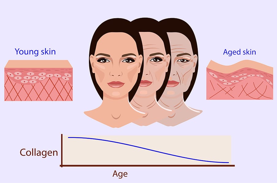 Microneedling – brief history and how it works on the ageing skin blog Illustration - shutterstock_720781873
